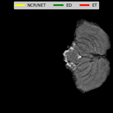 BrainSegNet demo animation